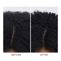 Dry Scalp Treatment 45 ml.